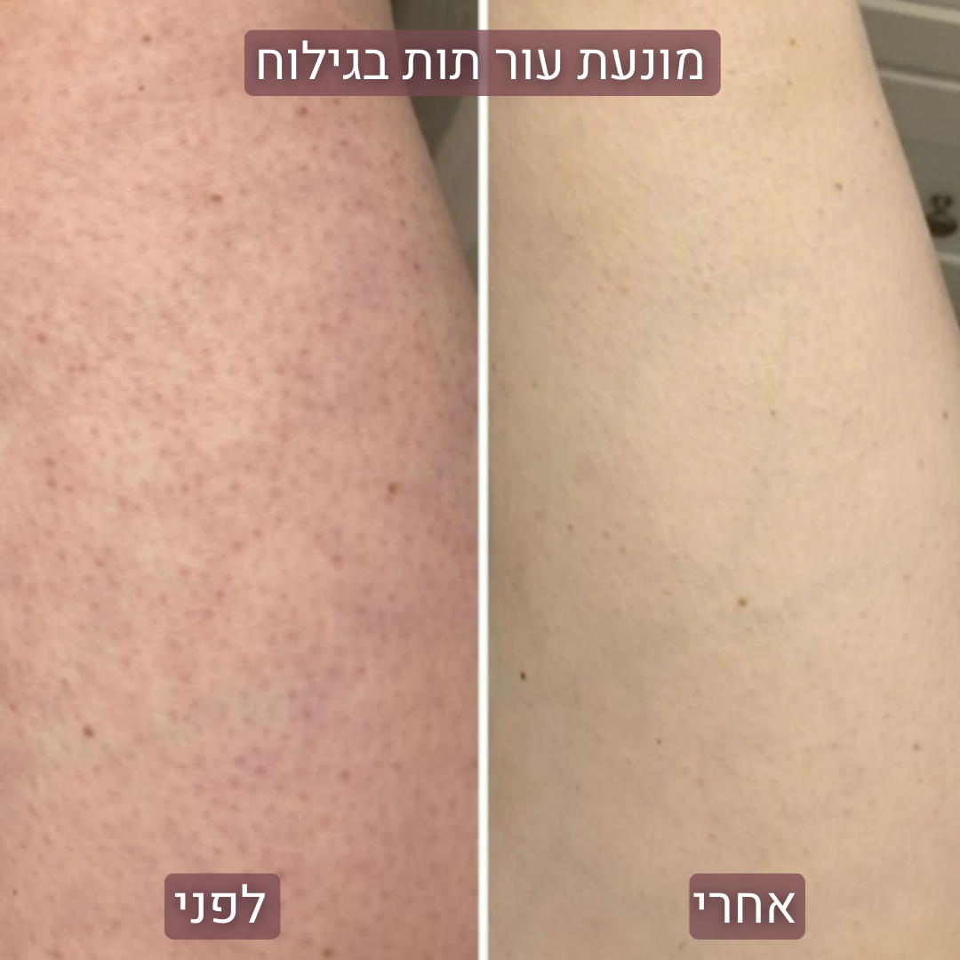 SilkPRO™ - מכונת הגילוח