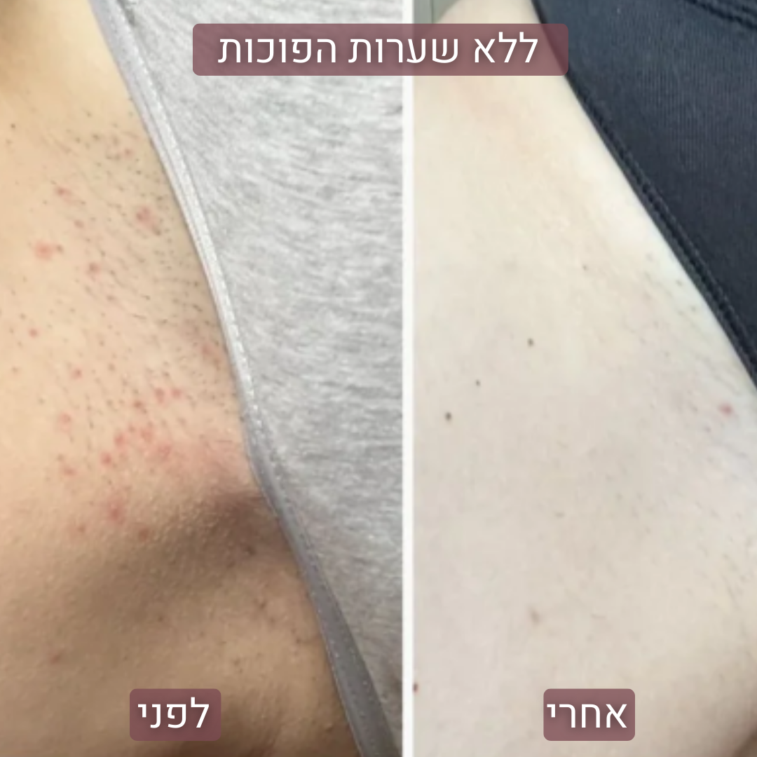 SilkPRO™ - מכונת הגילוח